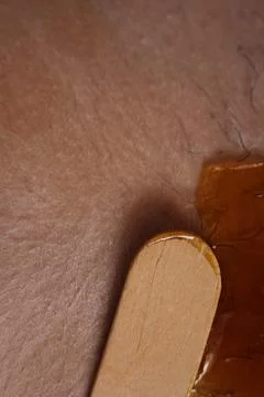 Epilation of the bikini area. Close-up of liquid wax hair removal. Shugaring Stock Photos
