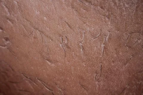 Epilation of the bikini area. Close-up of liquid wax hair removal. Shugaring Stock Photos