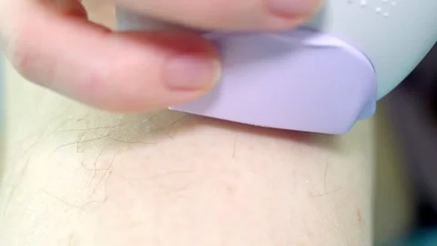 Epilation with a mechanical epilator Stock-Footage 267570000