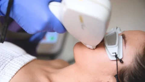 Epilation procedure Stock Footage 107984152