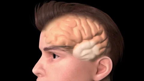 Epilepsy and seizures: abnormal neuronal discharges and brainwave disorders. Stockbeeldmateriaal 345199281
