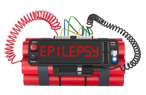 Epilepsy concept. Time bomb explosive with epilepsy word on timer, 3D renderi Stock Illustration