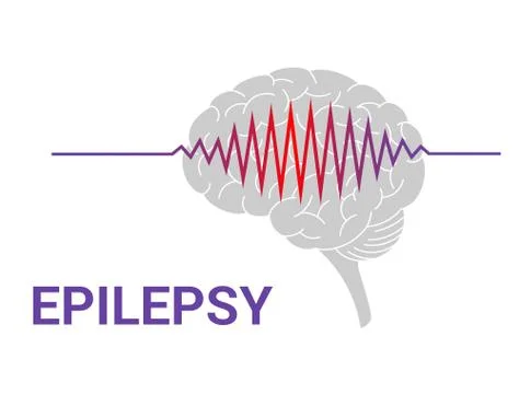 Epilepsy vector icon Stock Illustration
