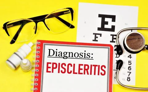 Episcleritis. Text label to indicate the state of vision health. Stock Photos