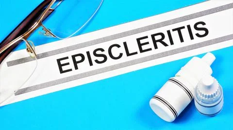 Episcleritis. A text label to indicate the state of vision health. Stock Photos