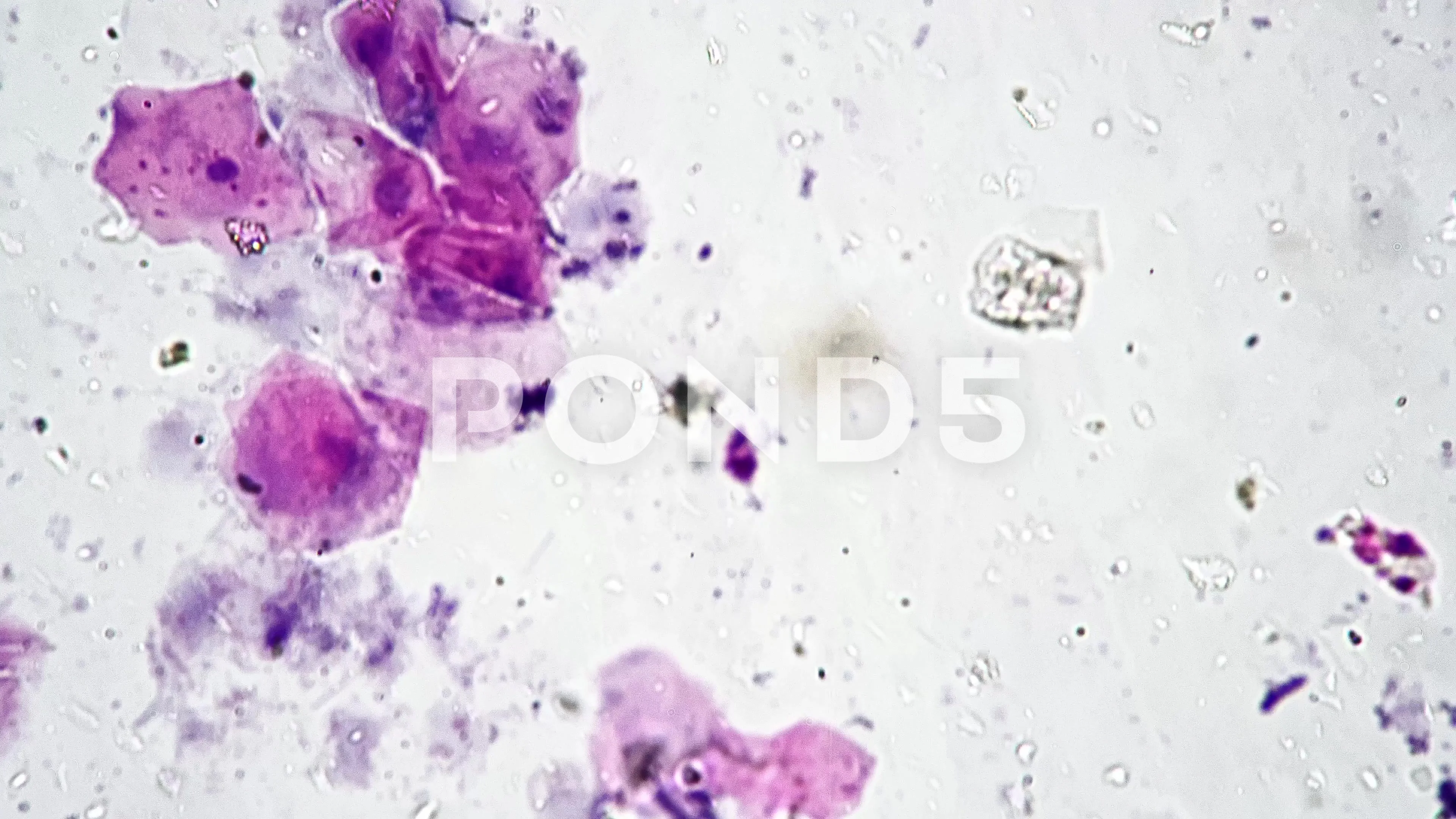 Epithelium cells of cavitas oris of human whole mount under microscope 400x on