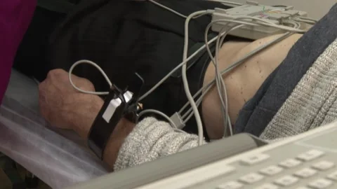 Equipment connected to the patient 1 Stock-Footage 317081319