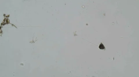 Escaping ciliate microscope view Stock Footage 68662594