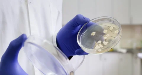 Escherichia coli. Stock Footage 318526381