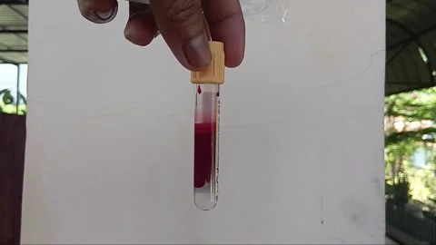 The Essential Guide to Blood Collection Tubes and Laboratory Analysis Stock Footage 325616748