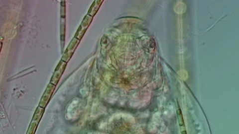 Euchlanis Dilatata Close-Up at 50x Under Nomarski DIC Microscopy Stock Footage 336944439