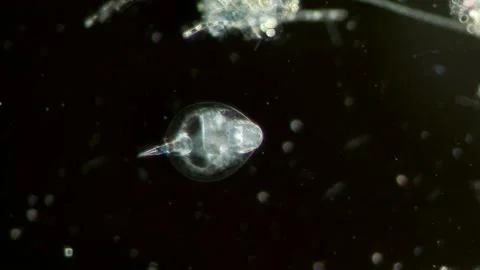 Euchlanis Dilatata Rotifer at 10x Under Darkfield Microscopy Stock Footage 336944018