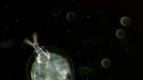 Euchlanis Dilatata Rotifer at 20x Under Darkfield Microscopy Stock Footage 336944400