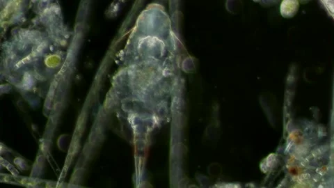 Euchlanis Rotifer at 20x Under Darkfield Microscopy, Biology Footage Stock Footage 336944438