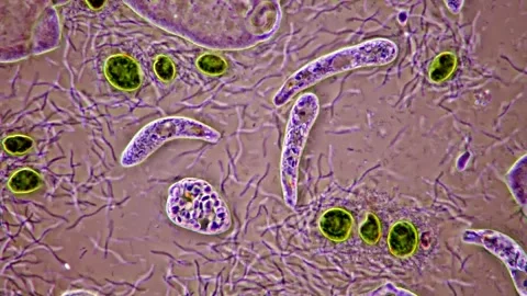 Euglena and bacteria under microscope, Microalgae life in pond water 400x 库存影片 318249562