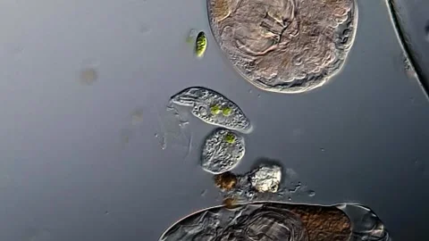 Euglena and rotifer under microscope view 库存影片 306575998
