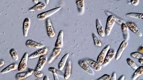 Euglena in pond water under microscope 库存影片 310640473