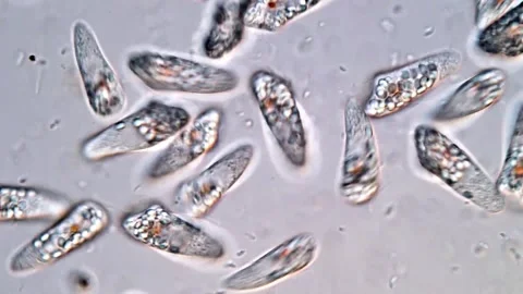 Euglena protozoa under microscope 스톡 동영상 310640713