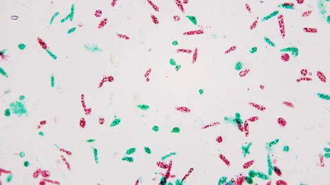 Euglena specimen under microscope. Promising raw material for biodisiel Stock Footage 266250174