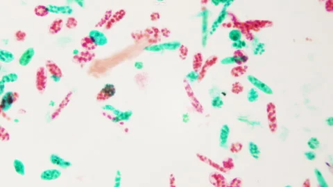 Euglena under microscope. Promising raw material for production of biodiesel  Stock Footage 266250272