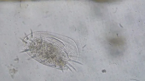 Euplotes in brackish water sample Video stock 127877742