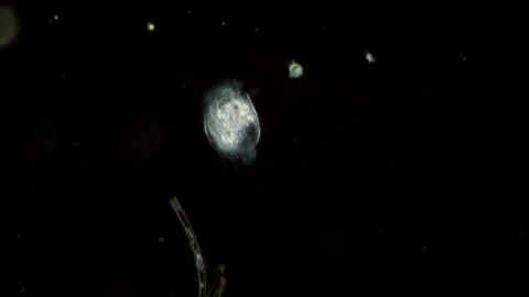 Euplotes Ciliate at 10x Under Darkfield Microscopy, Scientific Video Stock Footage 336944099