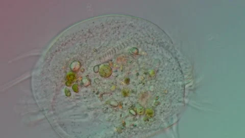 Euplotes Ciliate Close-Up at 50x Under Nomarski DIC Microscopy Stock Footage 336944131