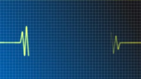 Euro beat Stock Footage 8986302