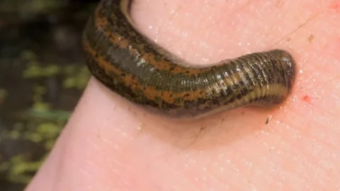 Wound and bleeding at leech bite. Close-, Stock Video