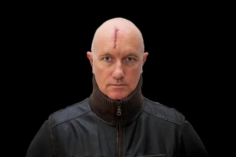 Evil looking man with a head injury on black background Stock Photos