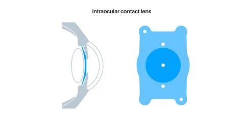 EVO ICL poster Stock Illustration