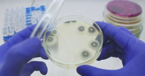 Examines mold colonies. Stock Footage 294536088