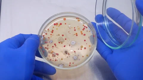 Examines the red colonies of microorganisms. Stock Footage 175403692