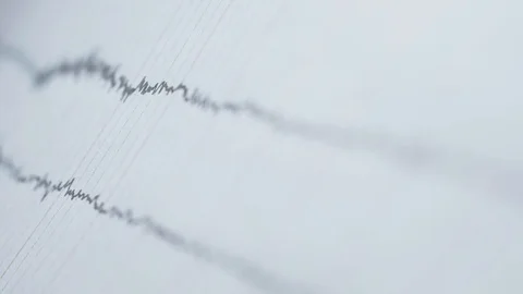 Examining Electroencephalogram Stock Footage 116310326