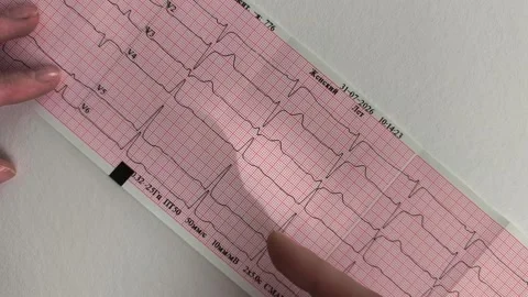 Examining printout electrocardiogram results to evaluate cardiac patient he.. Stock Footage 346161105