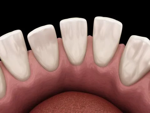 Excessive Spacing between teeth. Dental 3D illustration concept Illustrazione stock