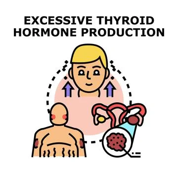 Excessive thyroid hormone production causing endocrine disorder Stock Illustration