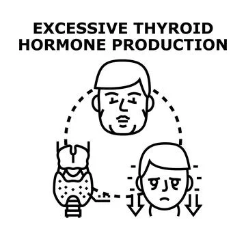 Excessive thyroid hormone production causing endocrine system imbalance Stock Illustration