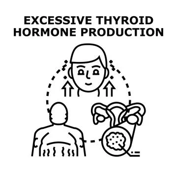 Excessive thyroid hormone production causing endocrine disorder Stock Illustration