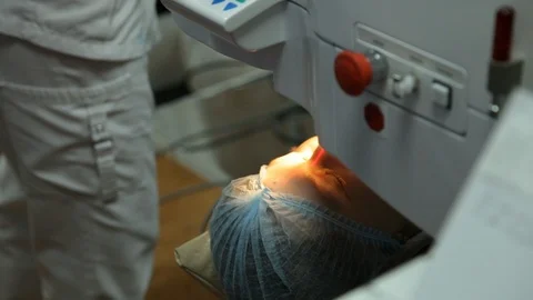 Excimer laser vision correction. corneal cutting of the eye. Stock Footage 113782200