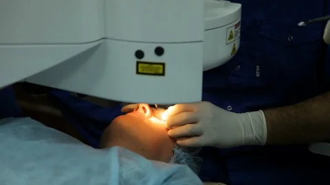 Excimer laser vision correction. surgeon work. Stock Footage 113780979