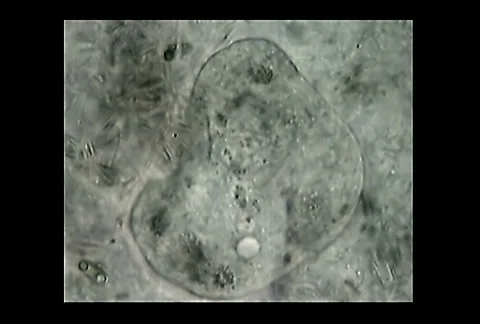 Excysting ameba Video stock 1200861