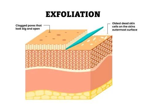 Exfoliation. Peeling or Physically scrubbing procedure. Removal of the old .. Stock Illustration