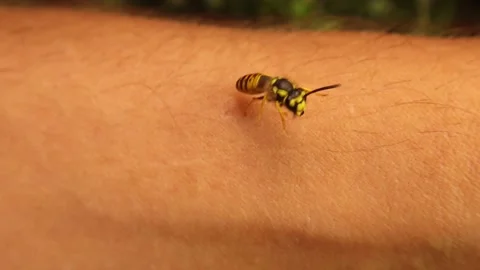Exotic vet gets his arm stung by a wasp, after two minutes, swelling occurs Stock Footage