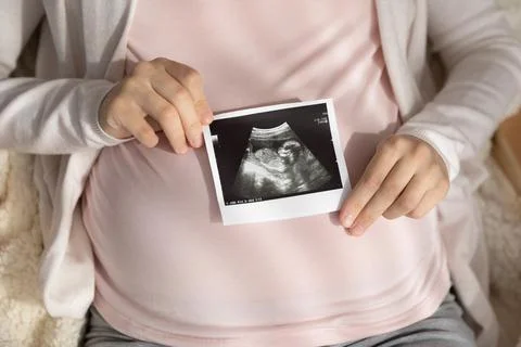 Expectant mother holding ultrasound scan at big tummy Stock Photos