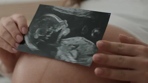 Expectant mother puts sonogram picture of small baby in womb on pregnant belly Stock Footage 169361110