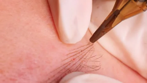 Expert designs microbladed line to blend with client existing hairs Stock Footage 278021543