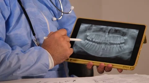 Explaining the x-ray results Stock Footage 247339835