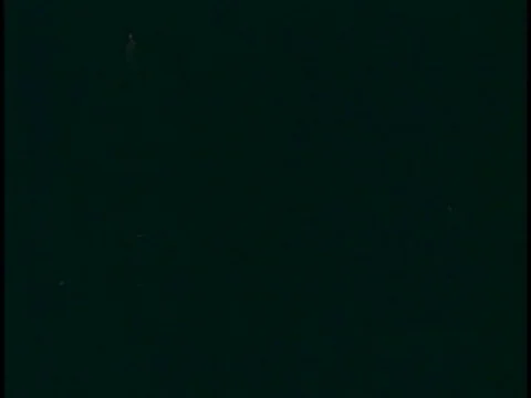 An explanation an illustration of how the nerves carry the signals to the brain Stock Footage