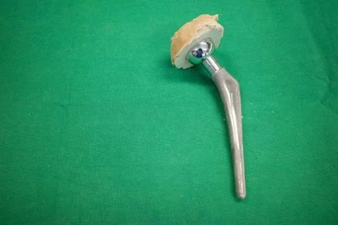 Explanted hip prosthesis was cleaned and lies on a green surgical drape. Stock Photos